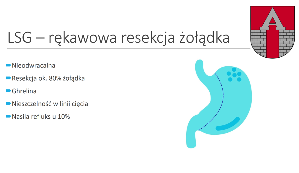 Zmniejszenie żołądka, rękawowa resekcja żoładka Łódź